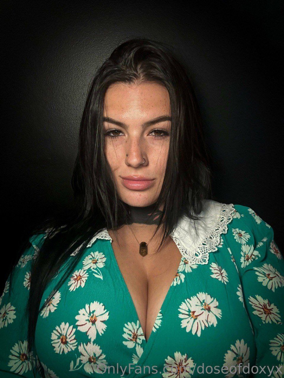 DoseOfDoxyx